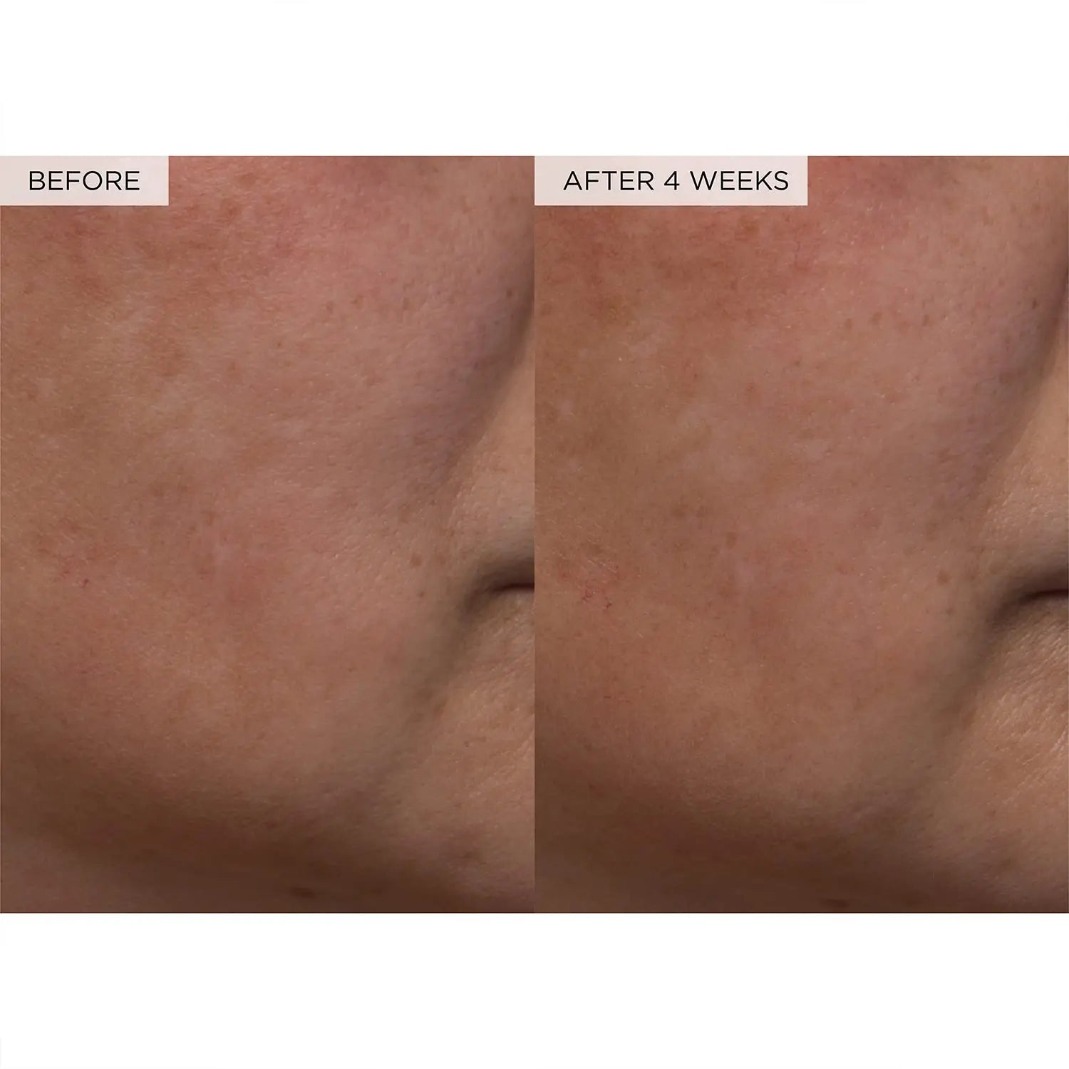 GLOW RECIPE WATERMELON GLOW P H A + B H A PORE-TIGHT TONER HYDRATING + PORE-REFINING TONIQUE 150ml